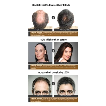 Средства для роста волос Предотвращают выпадение Эфирное масло Для быстрого роста кожи головы Красота и здоровье для мужчин Прямая поставка